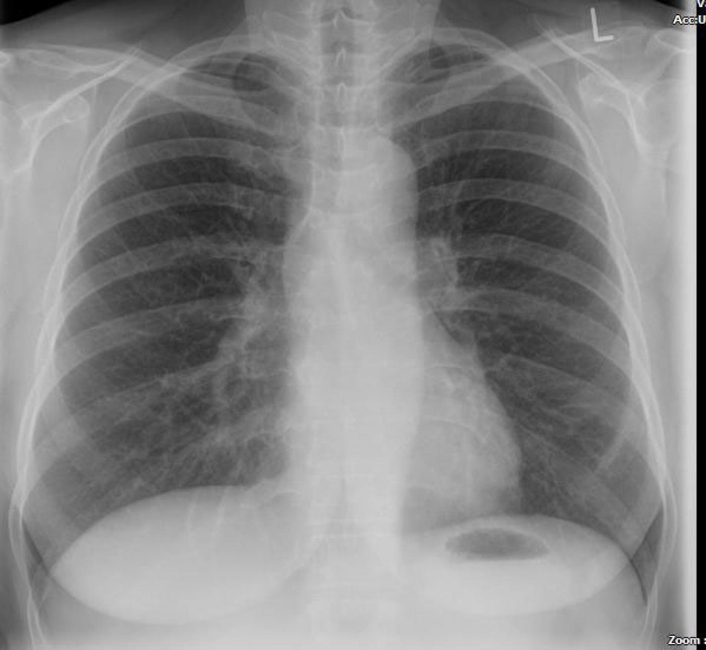 Röntgen, Röntgenaufnahme, Röntgenbilder erstellen | diagnostikzentrum Gießen